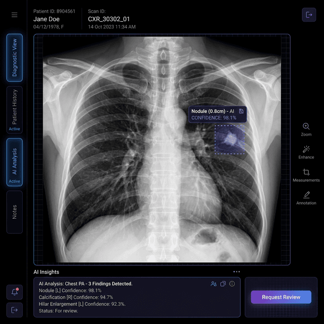 Chest X-ray